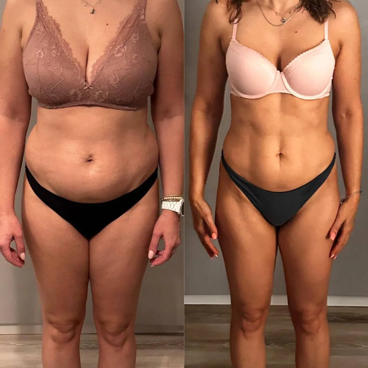 Fitness Progress Photo